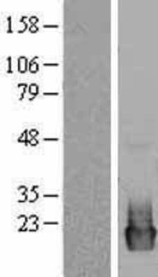 Western Blot: PRL-2/PTP4A2 Overexpression Lysate [NBL1-14960]