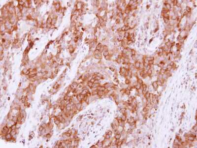 Immunohistochemistry-Paraffin: PTPN14/PTPD2 Antibody [NBP2-15069]