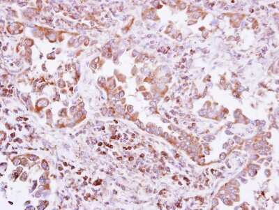 Immunohistochemistry-Paraffin: PTPN14/PTPD2 Antibody [NBP2-15070]