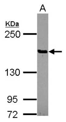 Western Blot: PTPN14/PTPD2 Antibody [NBP2-15070]