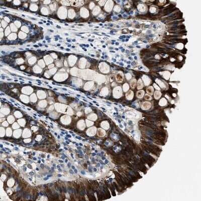 Immunohistochemistry-Paraffin: PTPDC1 Antibody [NBP1-81950]