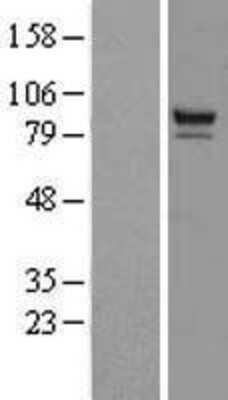 Western Blot: PTPDC1 Overexpression Lysate [NBL1-14962]