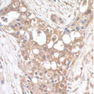 Immunohistochemistry-Paraffin: PTPIP51 Antibody [NBP1-47293]