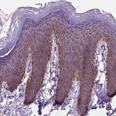 Immunohistochemistry-Paraffin: PTPIP51 Antibody [NBP1-84738]