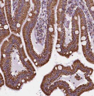 Immunohistochemistry-Paraffin: PTPIP51 Antibody [NBP1-84738]