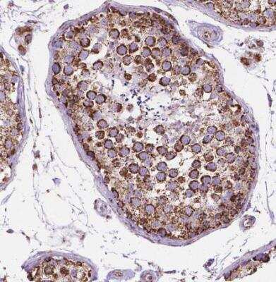 Immunohistochemistry-Paraffin: PTPIP51 Antibody [NBP1-84738]