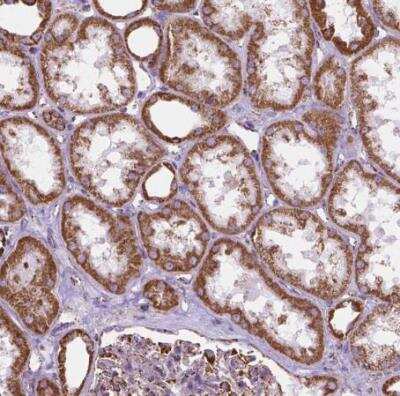 Immunohistochemistry-Paraffin: PTPIP51 Antibody [NBP1-84738]