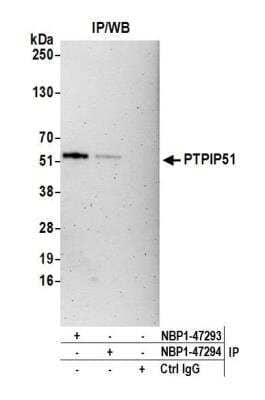 Immunoprecipitation: PTPIP51 Antibody [NBP1-47293]