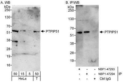 Immunoprecipitation: PTPIP51 Antibody [NBP1-47294]