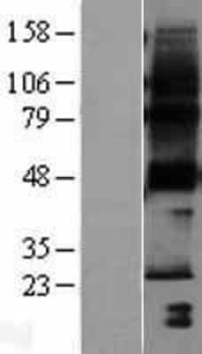 Western Blot: PTPLA Overexpression Lysate [NBL1-14964]