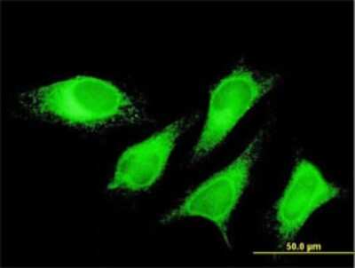 Immunocytochemistry/ Immunofluorescence: PTPLAD1 Antibody (5B5) [H00051495-M01]