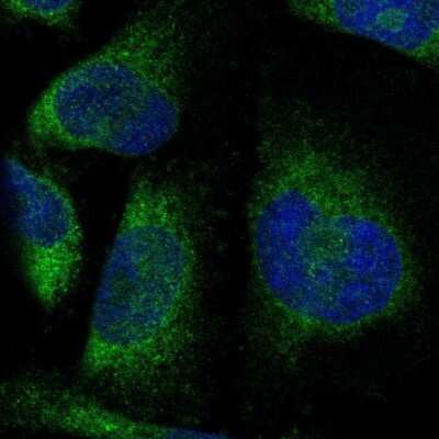 Immunocytochemistry/ Immunofluorescence: PTPLAD1 Antibody [NBP1-88597]