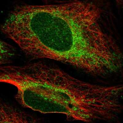 Immunocytochemistry/ Immunofluorescence: PTPLAD1 Antibody [NBP2-56963]