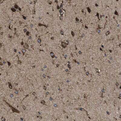 Immunohistochemistry-Paraffin: PTPLAD1 Antibody [NBP1-88597]