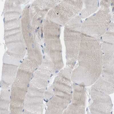 Immunohistochemistry-Paraffin: PTPLAD1 Antibody [NBP1-88597]