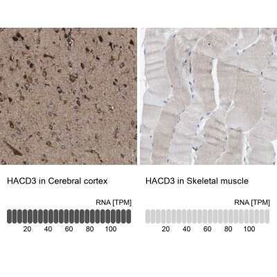 Immunohistochemistry-Paraffin: PTPLAD1 Antibody [NBP1-88597]