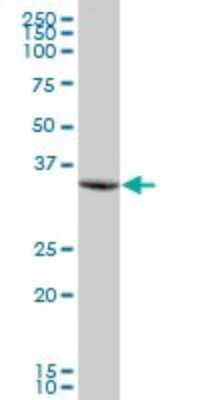 Western Blot: PTPLAD1 Antibody [H00051495-B01P]