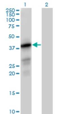 Western Blot: PTPLAD1 Antibody [H00051495-B01P]