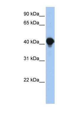 Western Blot: PTPLAD1 Antibody [NBP1-59028]