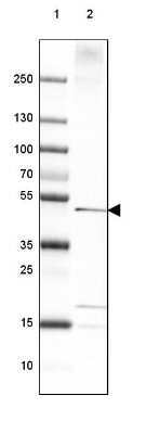 Western Blot: PTPLAD1 Antibody [NBP1-88597]