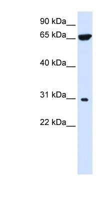 Western Blot: PTPLAD2 Antibody [NBP1-59414]