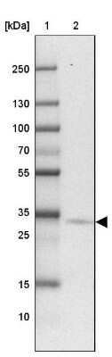 Western Blot: PTPLAD2 Antibody [NBP2-31725]