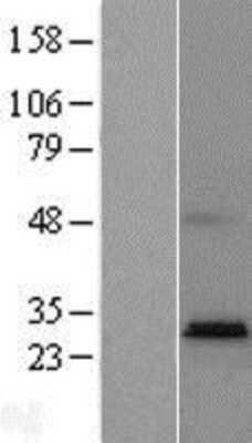 Western Blot: PTPLAD2 Overexpression Lysate [NBL1-14965]