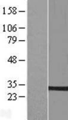 Western Blot: PTPLB Overexpression Lysate [NBL1-14966]