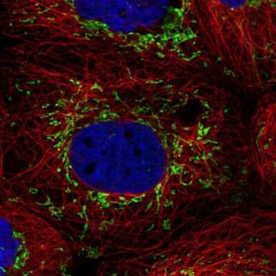 Immunocytochemistry/ Immunofluorescence: PTPMT1 Antibody [NBP2-13827]