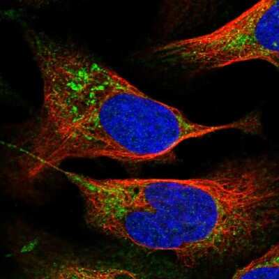 Immunocytochemistry/ Immunofluorescence: PTPMT1 Antibody [NBP2-55675]