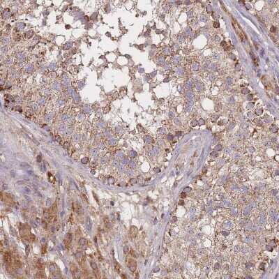 Immunohistochemistry-Paraffin: PTPMT1 Antibody [NBP2-13827]