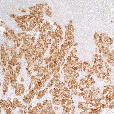 Immunohistochemistry: PTPN12 Antibody (BL-5-2F8) [NBP2-76395]