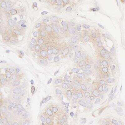 Immunohistochemistry: PTPN12 Antibody (BL-5-2F8) [NBP2-76395]