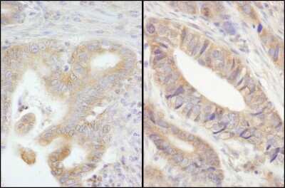 Immunohistochemistry: PTPN12 Antibody [NB100-60666]