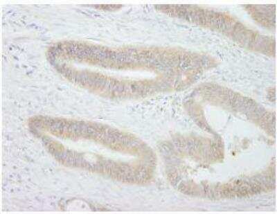 Immunohistochemistry-Paraffin: PTPN12 Antibody [NB100-60666]