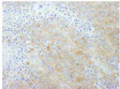 Immunohistochemistry-Paraffin: PTPN12 Antibody [NB100-60666]