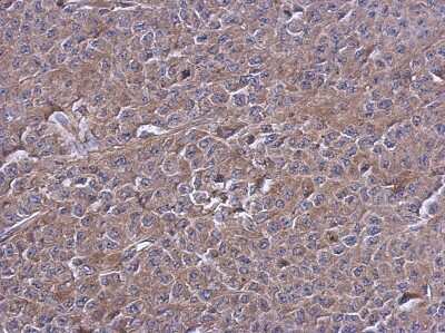 Immunohistochemistry-Paraffin: PTPN12 Antibody [NBP2-20004]