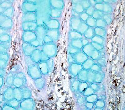 Immunohistochemistry-Paraffin: PTPN12 Antibody [NBP2-20004]