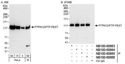 Western Blot: PTPN12 Antibody [NB100-60666]