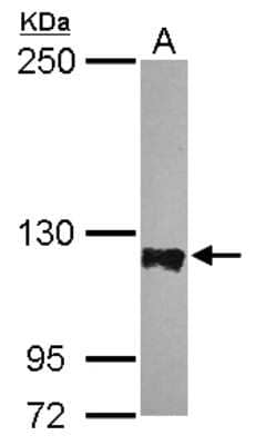 Western Blot: PTPN12 Antibody [NBP2-20004]