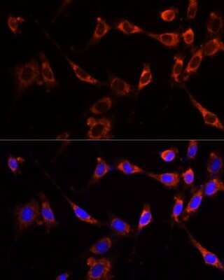 Immunocytochemistry/ Immunofluorescence: PTPN13/PTPL1 Antibody - Azide and BSA Free [NBP2-94207]