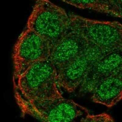 Immunocytochemistry/ Immunofluorescence: PTPN13/PTPL1 Antibody [NBP3-17189]