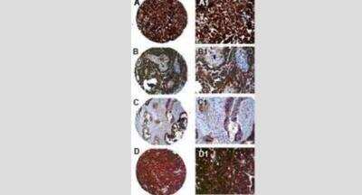 Immunohistochemistry-Paraffin: PTPN13/PTPL1 Antibody [NB100-56139]