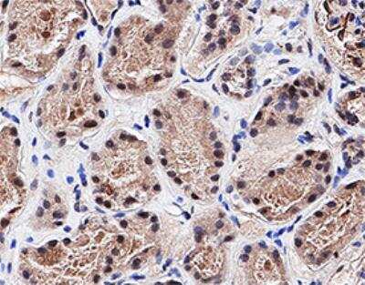 Immunohistochemistry-Paraffin: PTPN13/PTPL1 Antibody [NB100-56140]