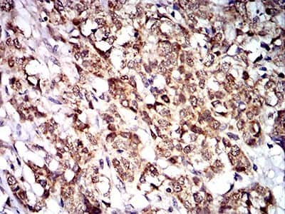 Immunohistochemistry: PTPN14/PTPD2 Antibody (2B3H7) - BSA Free [NBP2-61809]