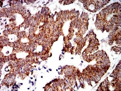 Immunohistochemistry: PTPN14/PTPD2 Antibody (2B3H7) - BSA Free [NBP2-61809]