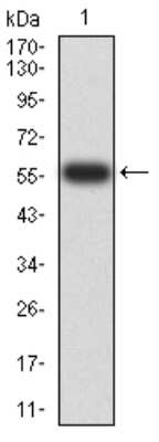 Western Blot: PTPN14/PTPD2 Antibody (2B3H7)BSA Free [NBP2-61809]