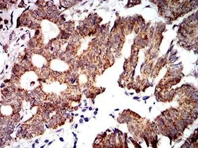 Immunohistochemistry-Paraffin: PTPN14/PTPD2 Antibody (2C12E3) - BSA Free [NBP2-61810]