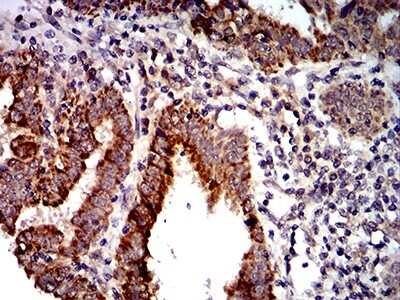 Immunohistochemistry-Paraffin: PTPN14/PTPD2 Antibody (2C12E3) - BSA Free [NBP2-61810]