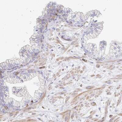 Immunohistochemistry-Paraffin: PTPN14/PTPD2 Antibody [NBP2-38712]